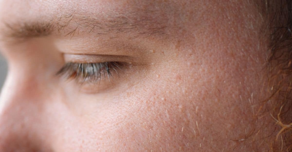Les produits de beauté peuvent-ils provoquer des lésions cutanées ?
