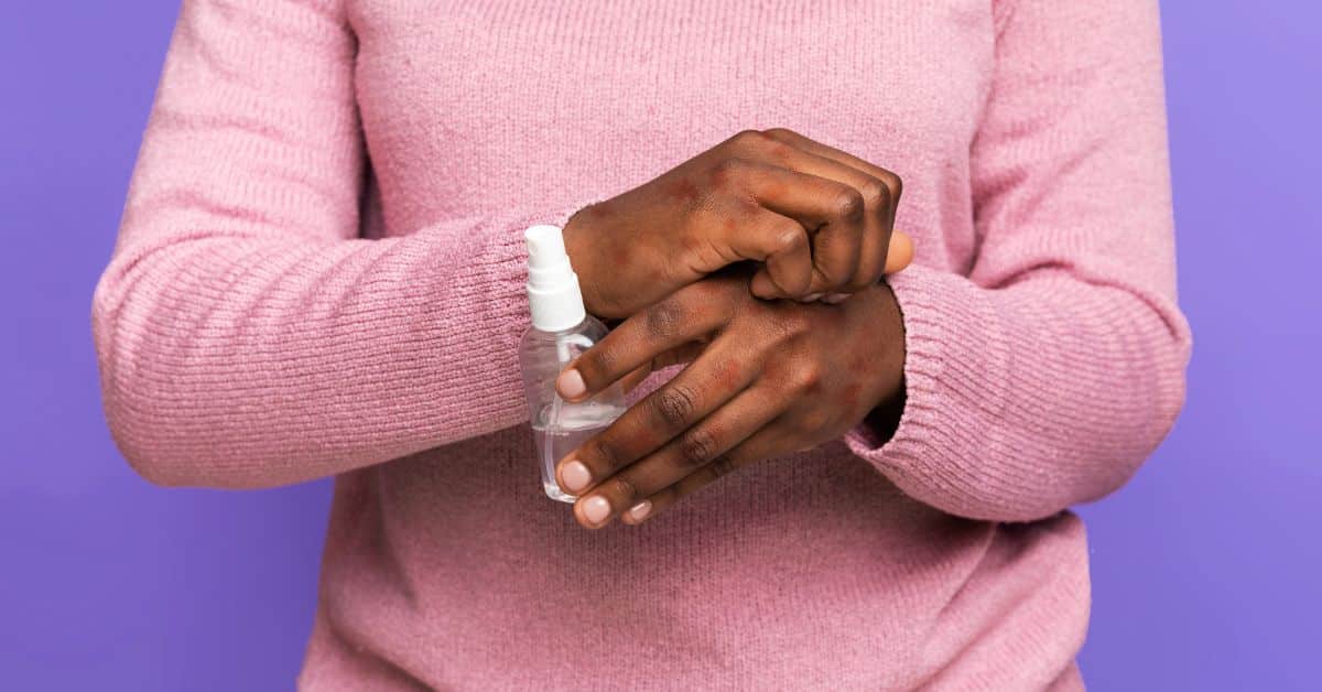 Comment vivre avec l’eczéma