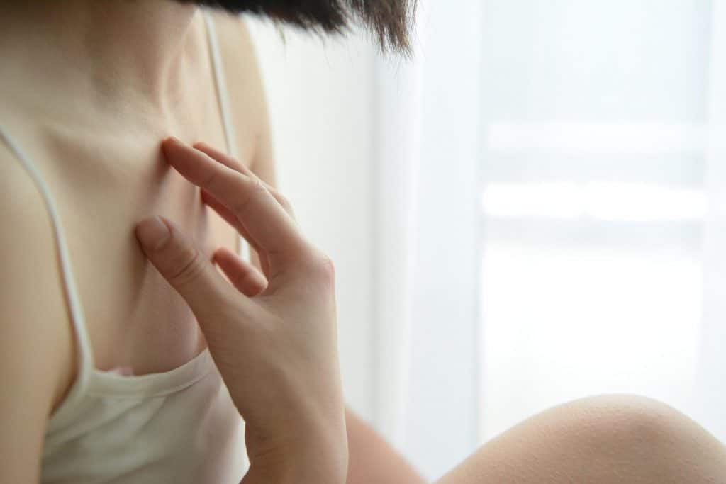 eczema